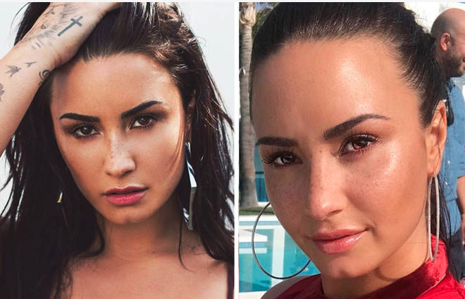 voz de demi lovato queda dañada emisoras unidas