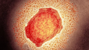 Partícula del virus de la viruela del mono